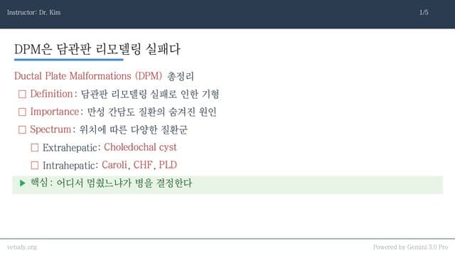담관판 기형(DPM) 완벽 정리: 총담관낭종부터 간섬유화까지